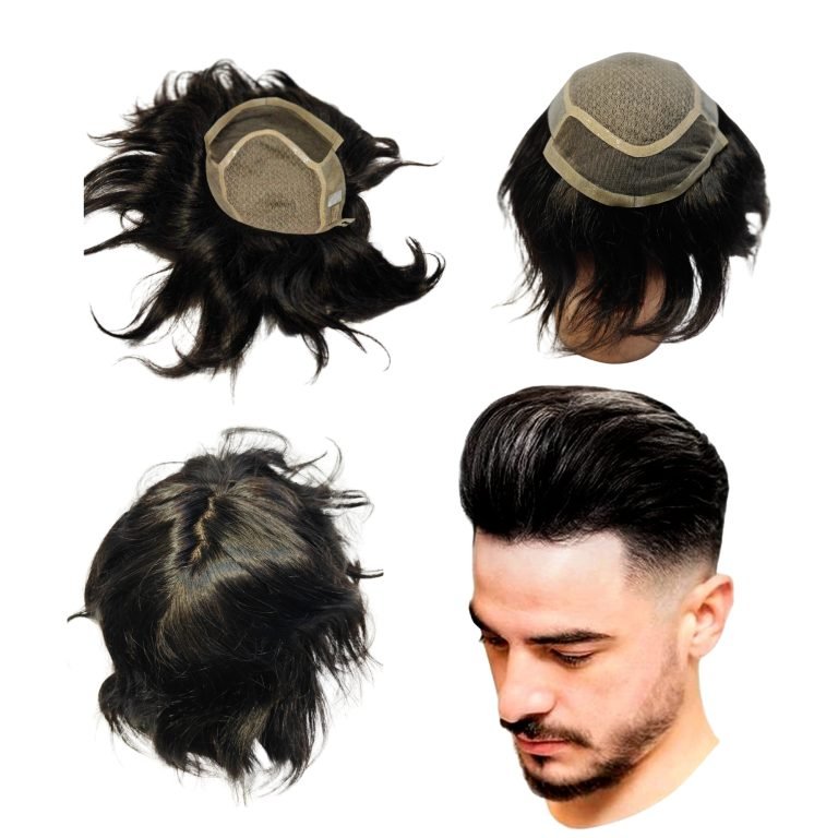Say Goodbye to Baldness: The Complete Guide to Hair Patches & Non-Surgical Hair Replacement